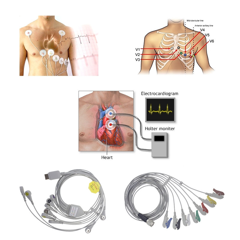 Holter ECG Accessories