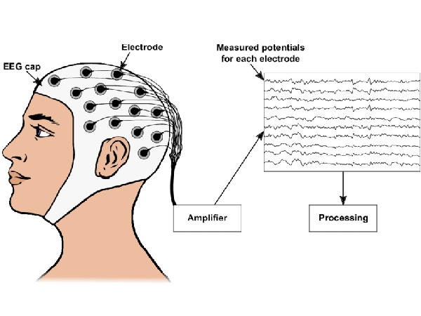 EEG