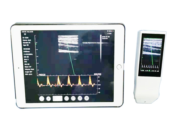 wireless Ultrasound transducer