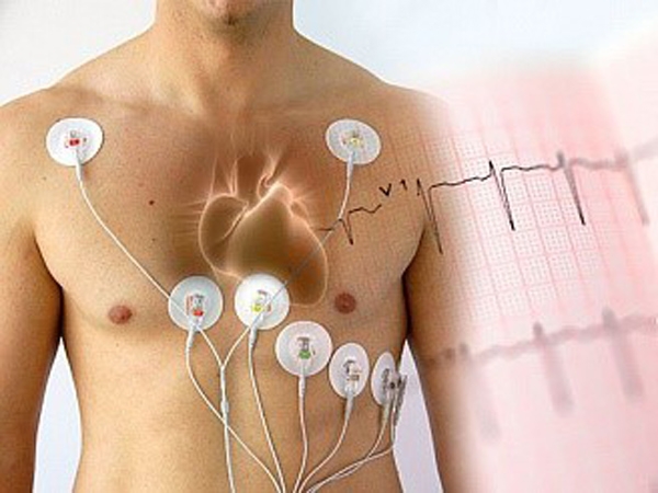 Holter ECG cable