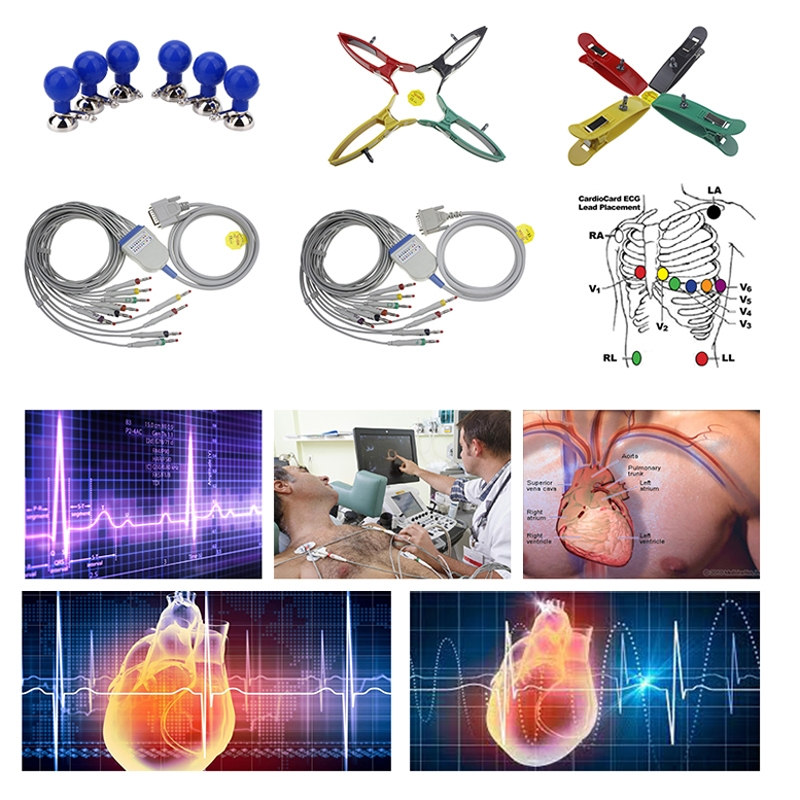 ECG & EKG Accessories